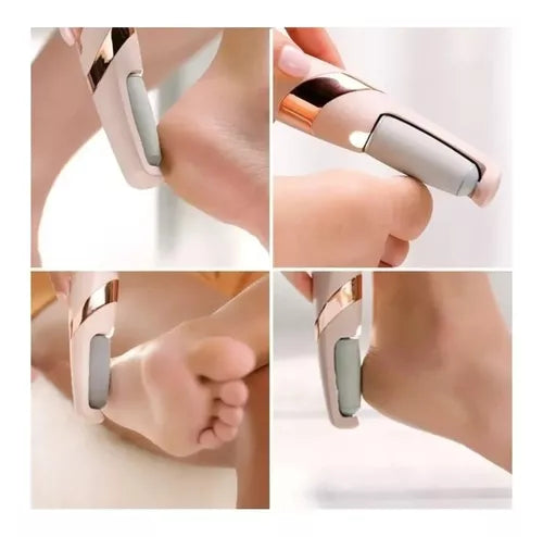 PEDIPRO™ Removedor de Callos